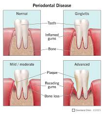 The Role Of Periodontists In Preventing Gum Disease 1 image 9